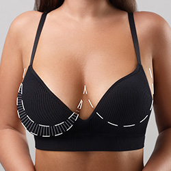 Breast LipoLift in Beverly Hills, CA