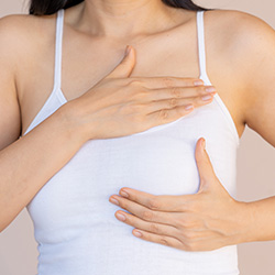 Tuberous Breasts in Beverly Hills, CA